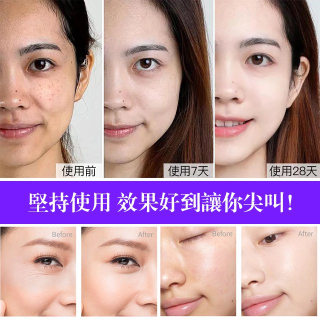 提拉緊致血清蛋白精華液,徹夜撫平細胞鬆弛,在家就可以改善淚溝 專抹法令紋,提拉緊緻皮膚,出門都自信! 提拉緊致血清蛋白精華液,徹夜撫平細胞鬆弛,在家就可以改善淚溝 專抹法令紋,提拉緊緻皮膚,出門都自信!